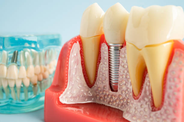 Professional Dental Services in Clarendon, AR